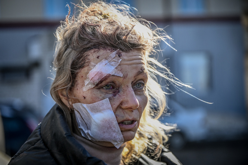 2022年2月24日，烏克蘭東北部的城市楚胡伊夫（Chuguyev）遭受俄軍轟炸，一位53歲的教師Helena的頭部被碎裂的大片玻璃割傷。（攝影／AFP／Aris Messinis）