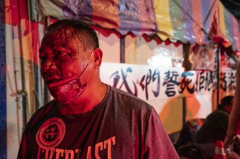 7月21日凌晨的衝突裡，一位龍昇村村民遭坤輿保全扔擲的硬物擊中，滿臉鮮血。（攝影／楊子磊）