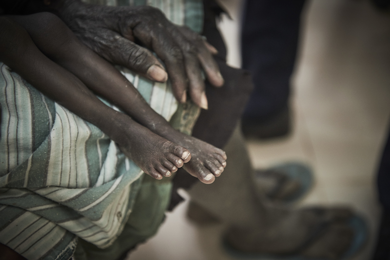 南蘇丹、艾卜耶、人道、醫療救援、無國界醫生