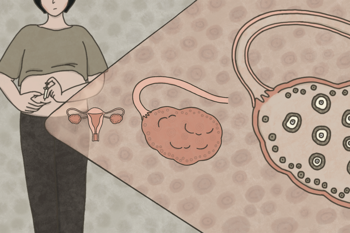 圖解新聞】解開卵子的祕密：女人一生會排多少卵？捐卵、凍卵怎麼做？風險大嗎？ - 報導者The Reporter